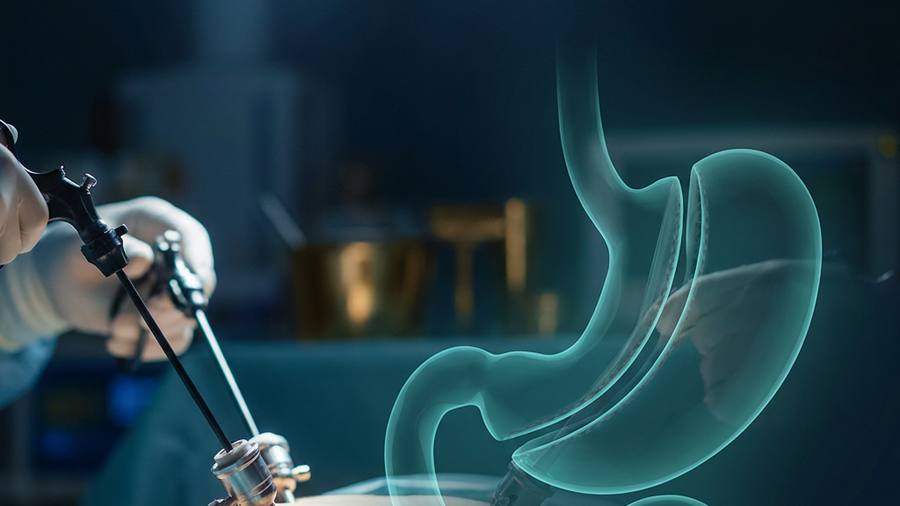 Laparoscopic bariatric surgery